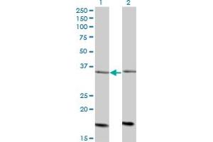 Western Blot analysis of ADCK4 expression in transfected 293T cell line by ADCK4 monoclonal antibody (M01), clone 1D9. (ADCK4 Antikörper  (AA 445-544))