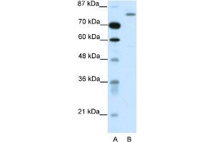 WB Suggested Anti-TRIM28 Antibody Titration:  1. (KAP1 Antikörper  (C-Term))