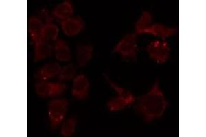 ABIN6276763 staining HeLa by IF/ICC. (MUTYH Antikörper  (Internal Region))