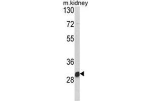 Western blot analysis of NAT2 Antibody (C-term) in mouse kidney tissue lysates (35ug/lane).