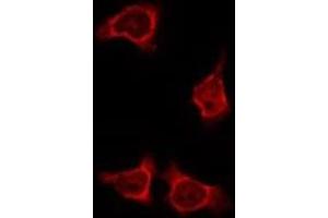 ABIN6275883 staining HeLa by IF/ICC. (IL4I1 Antikörper  (N-Term))