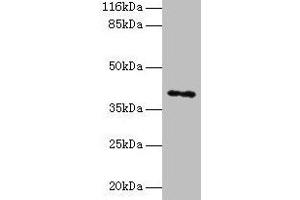 Western blot All lanes: MAGEA10 antibody at 2 μg/mL + HL60 whole cell lysate Secondary Goat polyclonal to rabbit IgG at 1/10000 dilution Predicted band size: 41 kDa Observed band size: 41 kDa (MAGEA1 Antikörper  (AA 2-225))