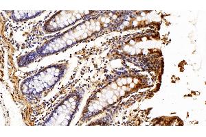 Immunohistochemistry (IHC) image for anti-S100 Calcium Binding Protein A6 (S100A6) (AA 1-90) antibody (ABIN7434041)