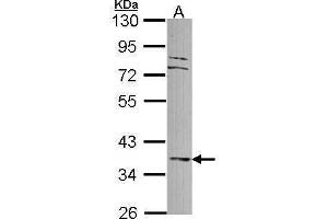 WB Image Sample (30 ug of whole cell lysate) A: A549 10% SDS PAGE antibody diluted at 1:1000 (DUSP6 Antikörper)