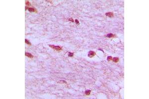 Immunohistochemical analysis of Lamin B1 staining in human brain formalin fixed paraffin embedded tissue section. (Lamin B1 Antikörper  (N-Term))