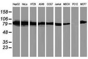 Image no. 2 for anti-Protein Kinase C, epsilon (PRKCE) antibody (ABIN1500229) (PKC epsilon Antikörper)