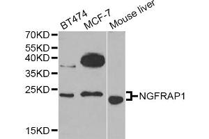 Western blot analysis of extracts of various cell lines, using NGFRAP1 Antibody (ABIN5974398) at 1/1000 dilution. (Nerve Growth Factor Receptor (TNFRSF16) Associated Protein 1 (NGFRAP1) Antikörper)