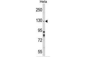 Western blot analysis of ITGA1 Antibody (Center) in Hela cell line lysates (35ug/lane). (Integrin alpha 1 Antikörper  (Middle Region))