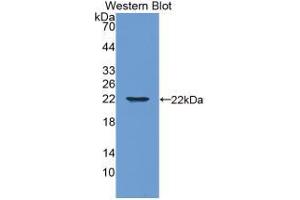 Western blot analysis of the recombinant protein. (Aggrecan Antikörper  (AA 34-147))