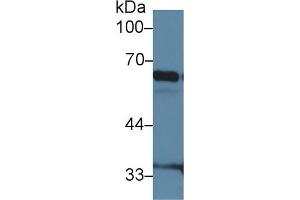 Western Blot; Sample: Mouse Lung lysate; Primary Ab: 2µg/ml Rabbit Anti-Mouse IkBz Antibody Second Ab: 0. (Inhibitory Subunit of NF-KappaB zeta (AA 414-654) Antikörper)
