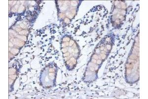 Immunohistochemistry of paraffin-embedded human small intestine tissue using ABIN7155104 at dilution of 1:100 (HNRNPD/AUF1 Antikörper  (AA 18-355))