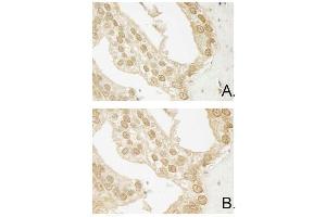 Immunohistochemistry of Mouse Anti-AKT3 antibody. (AKT3 Antikörper  (Internal Region))