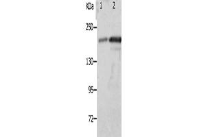 Western Blotting (WB) image for anti-Nephrosis 1, Congenital, Finnish Type (Nephrin) (NPHS1) antibody (ABIN2426273) (Nephrin Antikörper)