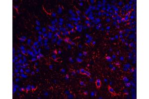 Immunofluorescence analysis of paraffin-embedded rat brain using GFAP Monoclonal Antibody at dilution of 1:400. (GFAP Antikörper)