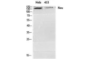Western Blot (WB) analysis of HeLa 453 cells using Neu Polyclonal Antibody. (NEURL Antikörper  (Ser357))