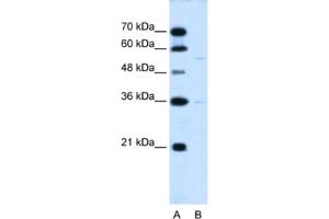 Western Blotting (WB) image for anti-Chromosome 19 Open Reading Frame 28 (C19orf28) antibody (ABIN2463998) (C19orf28 Antikörper)
