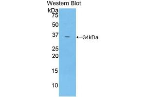 Western blot analysis of the recombinant protein. (TRAF5 Antikörper  (AA 181-437))