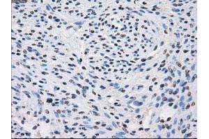 Immunohistochemical staining of paraffin-embedded colon tissue using anti-FHmouse monoclonal antibody. (FH Antikörper)