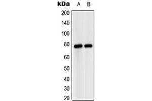 Western blot analysis of MASP2 expression in HeLa (A), SP2/0 (B) whole cell lysates. (MASP2 Antikörper  (Center))