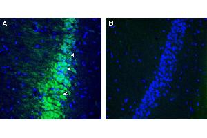 Expression of Contactin-2 in rat hippocampus.