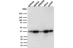 Western Blot Analysis of Human Kidney tissue, Human HepG2, HEK293, HeLa and Jurkat cell lysate using AKR1B1 Mouse Monoclonal Antibody (CPTC-AKR1B1-3). (AKR1B1 Antikörper)