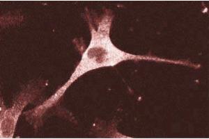 Immunofluorescence staining of human endothelial cells. (ENAH Antikörper  (AA 415-541))