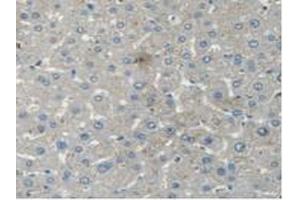 IHC-P analysis of Human Liver Tissue, with DAB staining. (STAM2 Antikörper  (AA 1-377))