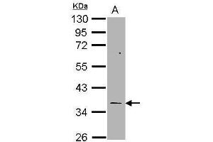 WB Image Sample (30 ug of whole cell lysate) A: H1299 10% SDS PAGE antibody diluted at 1:1000 (TYMS Antikörper)