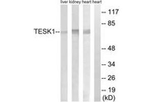 Western blot analysis of extracts from rat heart/rat kidney/rat liver cells, using TESK1 Antibody. (TESK1 Antikörper  (AA 181-230))