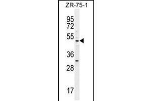 Western blot analysis in ZR-75-1 cell line lysates (35ug/lane). (MEF2D Antikörper  (N-Term))