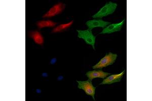 ABIN6264831 and ABIN6279042 staining  cells by IF/ICC. (RPL24 Antikörper  (Internal Region))