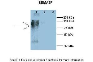 Researcher: Dr. (SEMA3F Antikörper  (N-Term))