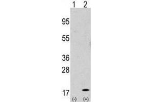 Western blot analysis of GABARAP antibody and 293 cell lysate either nontransfected (Lane 1) or transiently transfected with the GABARAP gene (2). (GABARAP Antikörper  (AA 1-30))