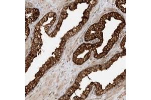 Immunohistochemical staining of human prostate with SCARF2 polyclonal antibody  strong cytoplasmic positivity in glandular cells at 1:200-1:500 dilution. (SCARF2 Antikörper)