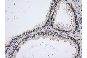 Immunohistochemical staining of paraffin-embedded Human Kidney tissue using anti-USP5 mouse monoclonal antibody. (USP5 Antikörper)