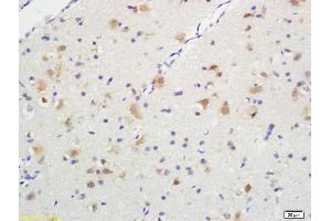 Formalin-fixed and paraffin embedded rat brain tissue labeled with Anti-Phospho-TrkA (Tyr490) /TrkB (Tyr516) Polyclonal Antibody, Unconjugated (ABIN746603) at 1:200, followed by conjugation to the secondary antibody and DAB staining (TRKA Antikörper  (pTyr496))