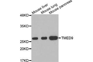 Western blot analysis of extracts of various cell lines, using TMED9 antibody. (TMED9 Antikörper)