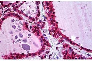 Human Thyroid: Formalin-Fixed, Paraffin-Embedded (FFPE) (ATF5 Antikörper  (AA 101-200))