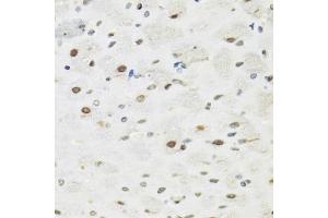 Immunohistochemistry of paraffin-embedded rat brain using SFPQ antibody (ABIN5970351) at dilution of 1/100 (40x lens). (SFPQ Antikörper)