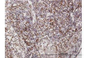Immunoperoxidase of purified MaxPab antibody to CD2 on formalin-fixed paraffin-embedded human lymph node. (CD2 Antikörper  (AA 1-351))
