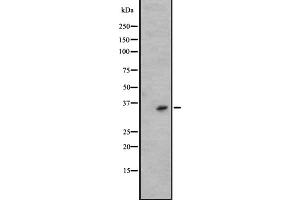 Western blot analysis of KLK6 expression in A431 whole cell lysate ,The lane on the left is treated with the antigen-specific peptide. (Kallikrein 6 Antikörper  (C-Term))