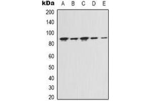 Western blot analysis of FAP alpha expression in Hela (A), MCF7 (B), NIH3T3 (C), mouse kidney (D), rat liver (E) whole cell lysates. (FAP Antikörper)