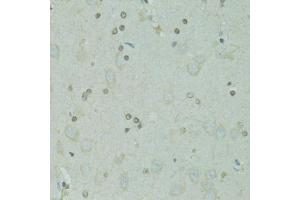 Immunohistochemistry of paraffin-embedded rat brain using GTF2H2C antibody (ABIN5973022) at dilution of 1/100 (40x lens). (GTF2H2C Antikörper)