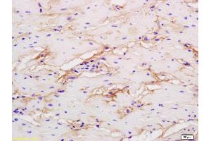 Formalin-fixed and paraffin embedded human colon labeled with Rabbit Anti phospho-LRP1(Ser4523) Polyclonal Antibody, Unconjugated (ABIN801648) at 1:200 followed by conjugation to the secondary antibody and DAB staining (LRP1 Antikörper  (pSer4523))
