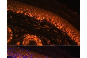 Immunofluorescence analysis of Rat skin using TYR Polyclonal Antibody at dilution of 1:100. (TYR Antikörper)