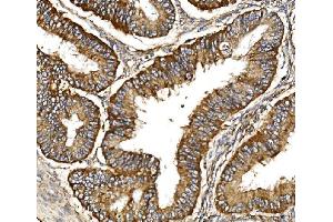 IHC analysis of TIMM29 using anti-TIMM29 antibody (ABIN7601495). (TIMM29 Antikörper  (AA 37-260))