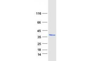 Western Blotting (WB) image for Dehydrogenase/reductase (SDR Family) Member 3 (DHRS3) protein (Myc-DYKDDDDK Tag) (ABIN2719451)