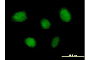 Immunofluorescence of purified MaxPab antibody to TNIP1 on HeLa cell.