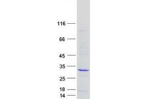 FAAP24 Protein (Myc-DYKDDDDK Tag)