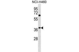 Western Blotting (WB) image for anti-NHL Repeat Containing 3 (NHLRC3) antibody (ABIN3001284) (NHLRC3 Antikörper)